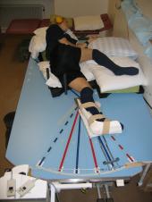 Graphical Abstract of Association between sensory function and hop performance and self-reported outcomes in patients with anterior cruciate ligament injury
