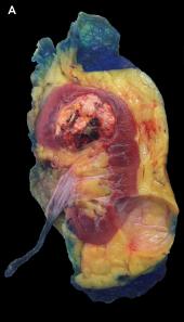 Graphical Abstract of Less toxic method for producing giant paper organ sections for pathology and anatomy education