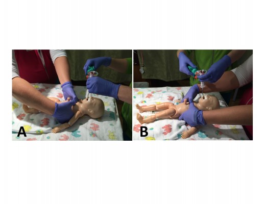Neonatal Resuscitation Advances In Training And Practice Amep