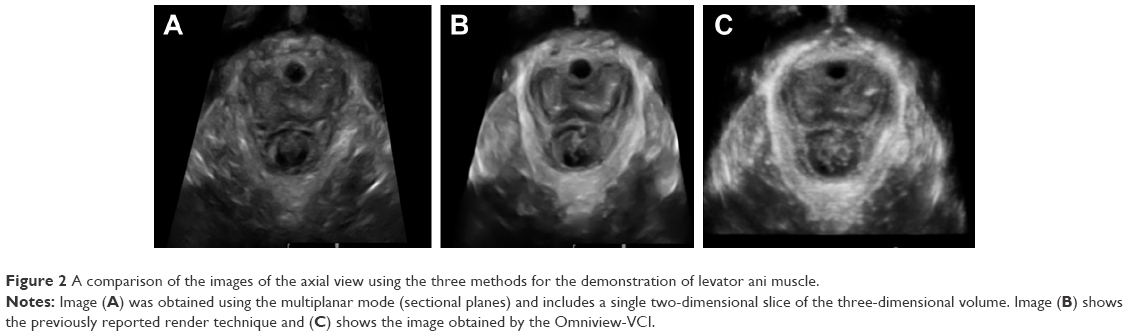 Three Dimensionalfour Dimensional Transperineal Ultrasound Clinical