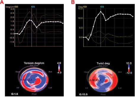 Age-related normal range of left ventricular strain and torsion using  three-dimensional speckle-tracking echocardiography.