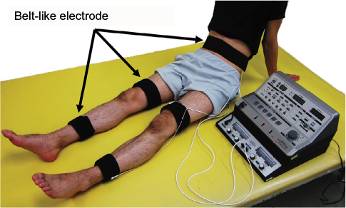Neuromuscular and Functional Electrical Stimulation