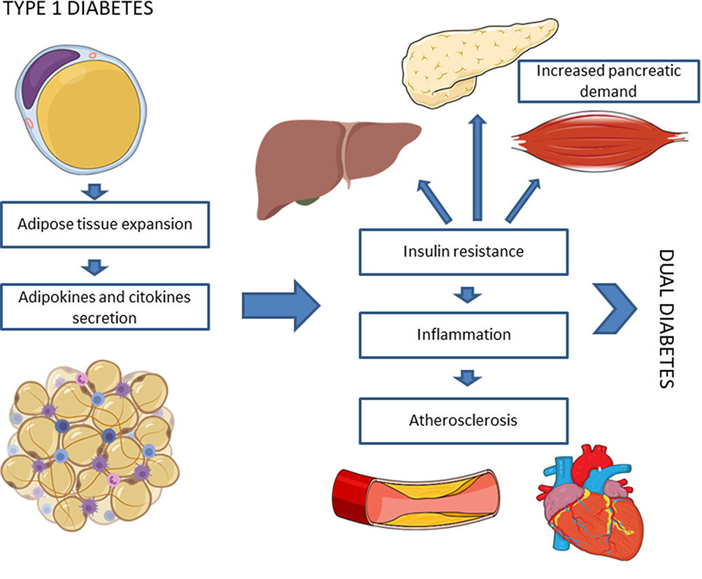 The Complex Relationship Between Type 1 Diabetes and Fatigue– Kaio-Dia