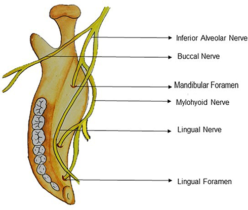 Mandibular Nerve Entrapment