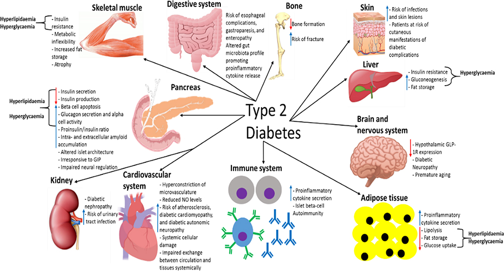 Diabetes tipo 1 y 2 cual es peor